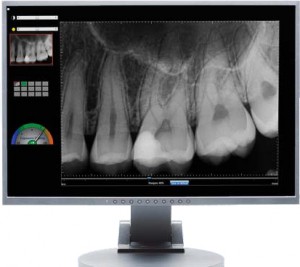 schick-33-by-sirona